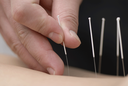 Akupunktur Zararlar